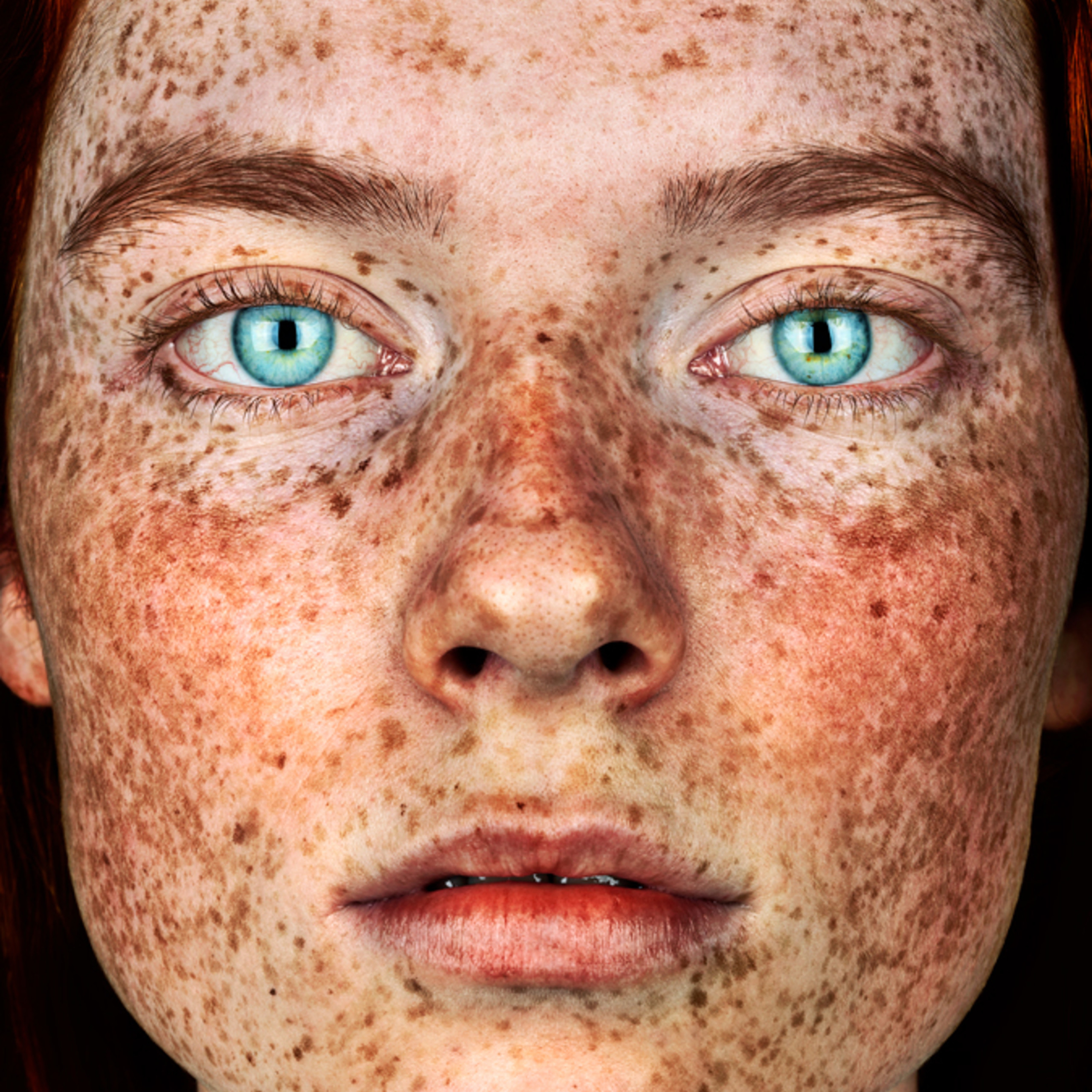 Brock Elbank | The New Freckles Portrait