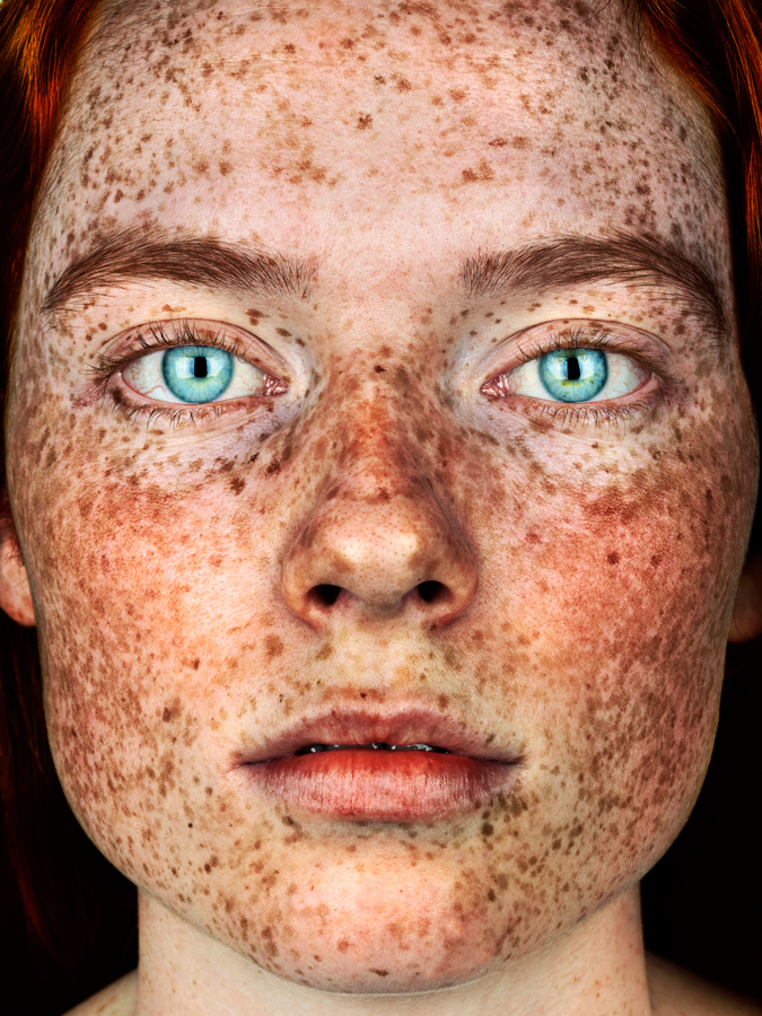 Brock Elbank | The New Freckles Portrait